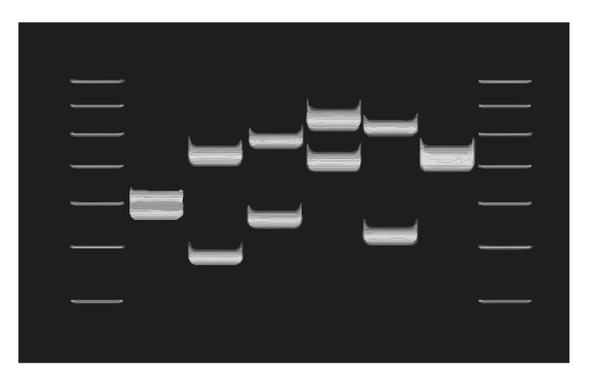 A gel electrophoresis image showing multiple bands of DNA fragments.