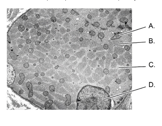 Electron micrograph showing a transverse section of a skeletal muscle fibre with labels A, B, C, and D pointing to different regions.