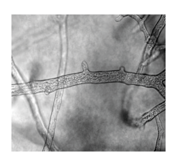 Micrograph showing aseptate fungal hyphae, labeled as 'Aseptate fungal hyphae'.