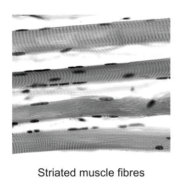 Micrograph showing striated muscle fibres, labeled as 'Striated muscle fibres'.