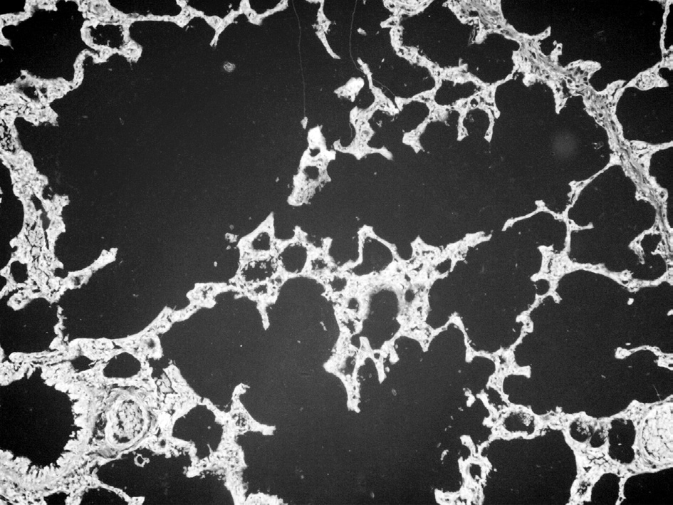 Embedded figure page 11