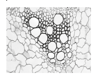 Light micrograph showing a cross-section of xylem vessels, as referenced in Question 4.
