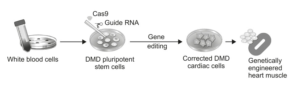 Flowchart diagram illustrating the process of gene editing starting from white blood cells, converting them to DMD pluripotent stem cells, undergoing gene editing with Cas9 and Guide RNA, resulting in corrected DMD cardiac cells, and finally genetically engineered heart muscle.