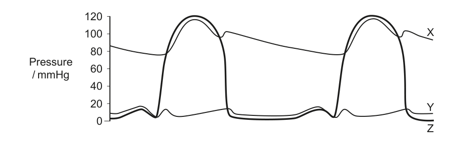 Graph showing pressure changes during the cardiac cycle with pressure in mmHg on the y-axis and time on the x-axis (implied). Three lines, X, Y, and Z, represent different pressure changes.