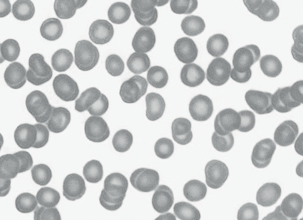 Embedded figure page 10