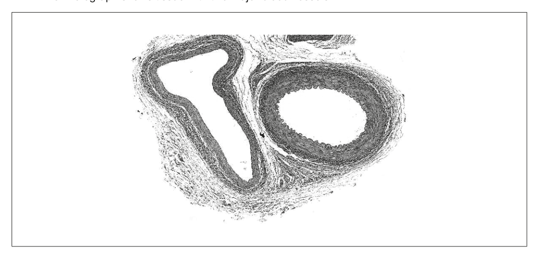 Micrograph showing a cross-section of two blood vessels, one with a thicker, more circular wall (likely an artery) and another with a thinner, more irregular wall (likely a vein).