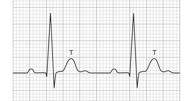 Figure region page 30