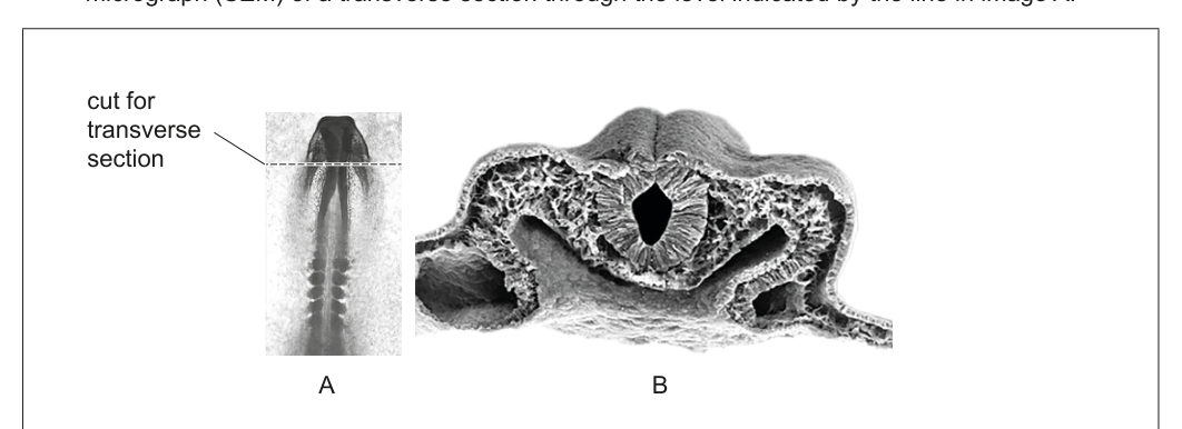 Image A shows a chick embryo with a line indicating a transverse section. Image B is a scanning electron micrograph (SEM) of that transverse section, showing the neural tube and ectoderm.